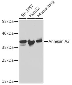 Invitrogen Annexin A2 Polyclonal Antibody 100 &mu;L; Unconjugated:Antibodies,