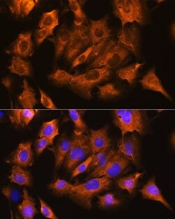 ATP1B1 Polyclonal Antibody, Invitrogen 100 &mu;L; Unconjugated:Antibodies,