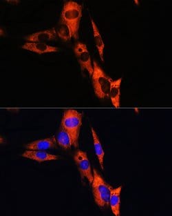 ATP1B1 Polyclonal Antibody, Invitrogen 100 &mu;L; Unconjugated:Antibodies,