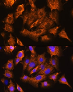 ATP1B1 Polyclonal Antibody, Invitrogen 100 &mu;L; Unconjugated:Antibodies,