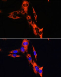 ATP1B1 Polyclonal Antibody, Invitrogen 100 &mu;L; Unconjugated:Antibodies,