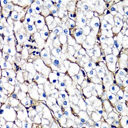 Invitrogen beta-2 Microglobulin Polyclonal Antibody 100 &mu;L; Unconjugated:Antibodies,
