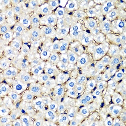 Invitrogen beta-2 Microglobulin Polyclonal Antibody 100 &mu;L; Unconjugated:Antibodies,