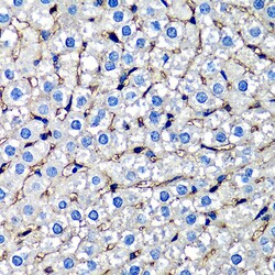 Invitrogen beta-2 Microglobulin Polyclonal Antibody 100 &mu;L; Unconjugated:Antibodies,