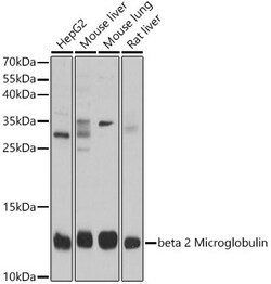 Invitrogen beta-2 Microglobulin Polyclonal Antibody 100 &mu;L; Unconjugated:Antibodies,