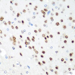 Invitrogen CDK1 Polyclonal Antibody 100 &mu;L; Unconjugated:Antibodies,