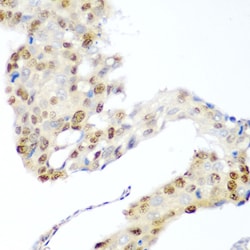 Invitrogen CDK1 Polyclonal Antibody 100 &mu;L; Unconjugated:Antibodies,