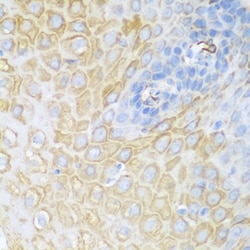 Invitrogen CDK1 Polyclonal Antibody 100 &mu;L; Unconjugated:Antibodies,