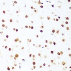 Invitrogen CDK1 Polyclonal Antibody 100 &mu;L; Unconjugated:Antibodies,