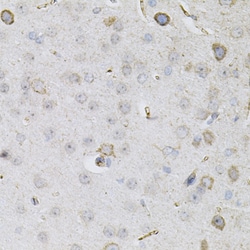 Invitrogen CEACAM5 Polyclonal Antibody 100 &mu;L | Buy Online | Invitrogen&trade; | Fisher Scientific