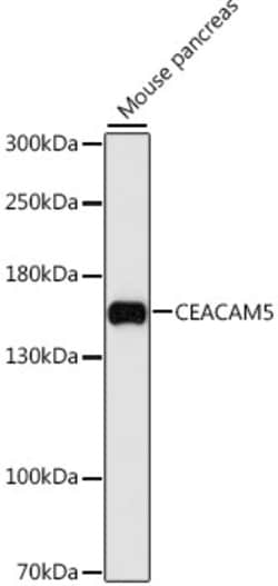 Invitrogen CEACAM5 Polyclonal Antibody 100 &mu;L | Buy Online | Invitrogen&trade; | Fisher Scientific