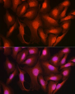 Invitrogen Ataxin 3 Polyclonal Antibody 100 &mu;L; Unconjugated:Antibodies,
