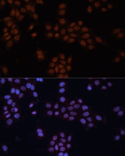 Invitrogen GTF2I Polyclonal Antibody 100 &mu;L; Unconjugated:Antibodies,