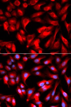Invitrogen RHAMM Polyclonal Antibody 100 &mu;L; Unconjugated:Antibodies,