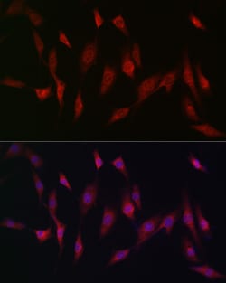 Invitrogen MSRA Polyclonal Antibody 100 &mu;L; Unconjugated:Antibodies,