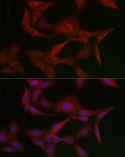 Invitrogen MSRA Polyclonal Antibody 100 &mu;L; Unconjugated:Antibodies,