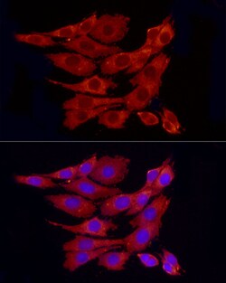Invitrogen PP1 alpha Polyclonal Antibody 100 &mu;L | Buy Online | Invitrogen&trade; | Fisher Scientific