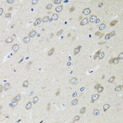 Invitrogen OGDH Polyclonal Antibody 100 &mu;L; Unconjugated:Antibodies,