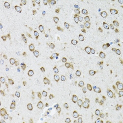 Invitrogen OGDH Polyclonal Antibody 100 &mu;L; Unconjugated:Antibodies,