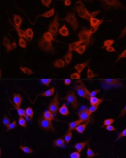 Invitrogen alpha-1 Antitrypsin Polyclonal Antibody 100 &mu;L; Unconjugated:Antibodies,