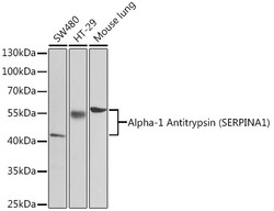 Invitrogen alpha-1 Antitrypsin Polyclonal Antibody 100 &mu;L; Unconjugated:Antibodies,