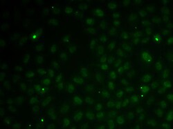 Invitrogen RAD51C Polyclonal Antibody 100 &mu;L; Unconjugated:Antibodies,
