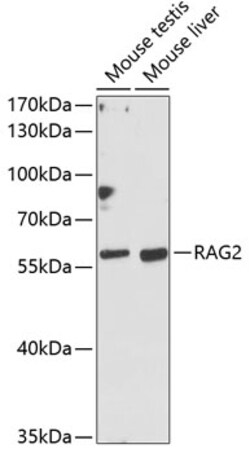 Invitrogen RAG2 Polyclonal Antibody 100 &mu;L; Unconjugated:Antibodies,