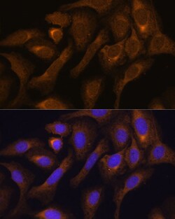 Invitrogen SHMT1 Polyclonal Antibody 100 &mu;L; Unconjugated:Antibodies,