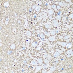 Invitrogen VAMP2 Polyclonal Antibody 100 &mu;L; Unconjugated:Antibodies,