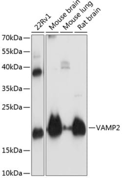 Invitrogen VAMP2 Polyclonal Antibody 100 &mu;L; Unconjugated:Antibodies,