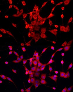 Invitrogen PEX5 Polyclonal Antibody 100 &mu;L; Unconjugated:Antibodies,