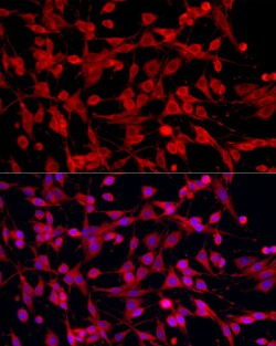 Invitrogen PEX5 Polyclonal Antibody 100 &mu;L; Unconjugated:Antibodies,