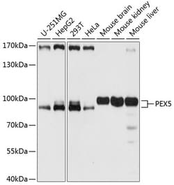 Invitrogen PEX5 Polyclonal Antibody 100 &mu;L; Unconjugated:Antibodies,