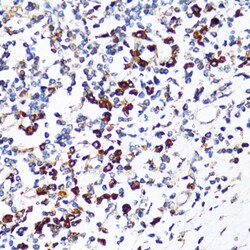 Invitrogen Ribophorin I Polyclonal Antibody 100 &mu;L; Unconjugated:Antibodies,