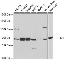 Invitrogen Ribophorin I Polyclonal Antibody 100 &mu;L; Unconjugated:Antibodies,