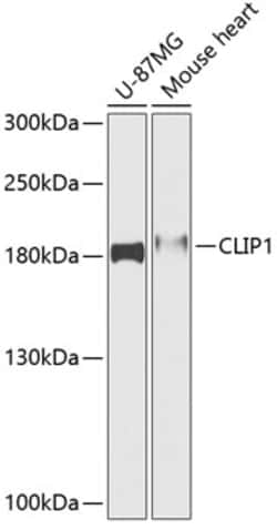 Invitrogen CLIP1 Polyclonal Antibody 100 &mu;L | Buy Online | Invitrogen&trade; | Fisher Scientific