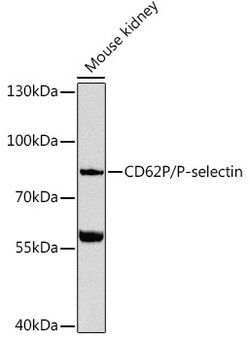 Invitrogen P-Selectin Polyclonal Antibody 100 &mu;L; Unconjugated:Antibodies,