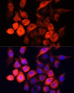 Invitrogen SHH Polyclonal Antibody 100 &mu;L; Unconjugated:Antibodies,