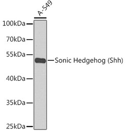 Invitrogen SHH Polyclonal Antibody 100 &mu;L; Unconjugated:Antibodies,