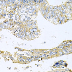 Invitrogen HDAC3 Polyclonal Antibody 100 &mu;L; Unconjugated:Antibodies,