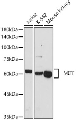 Invitrogen MiTF Polyclonal Antibody 100 &mu;L; Unconjugated:Antibodies,