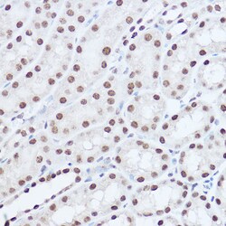 Invitrogen SAFB2 Polyclonal Antibody 100 &mu;L; Unconjugated:Antibodies,
