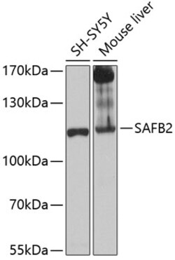 Invitrogen SAFB2 Polyclonal Antibody 100 &mu;L; Unconjugated:Antibodies,