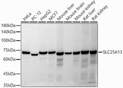 Invitrogen SLC25A13 Polyclonal Antibody 100 &mu;L; Unconjugated:Antibodies,