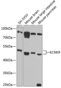 Invitrogen KCNK9 Polyclonal Antibody 100 &mu;L; Unconjugated:Antibodies,