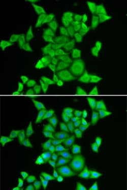 Invitrogen STRN3 Polyclonal Antibody 100 &mu;L; Unconjugated:Antibodies,