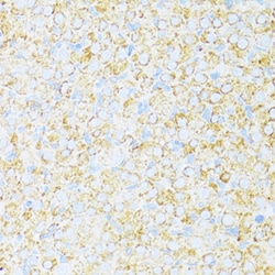 Invitrogen UCRC Polyclonal Antibody 100 &mu;L; Unconjugated:Antibodies,