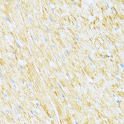 Invitrogen UCRC Polyclonal Antibody 100 &mu;L; Unconjugated:Antibodies,
