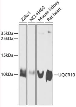 Invitrogen UCRC Polyclonal Antibody 100 &mu;L; Unconjugated:Antibodies,