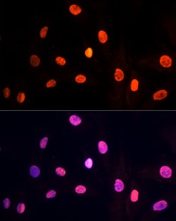 Invitrogen PRP19 Polyclonal Antibody 100 &mu;L; Unconjugated:Antibodies,